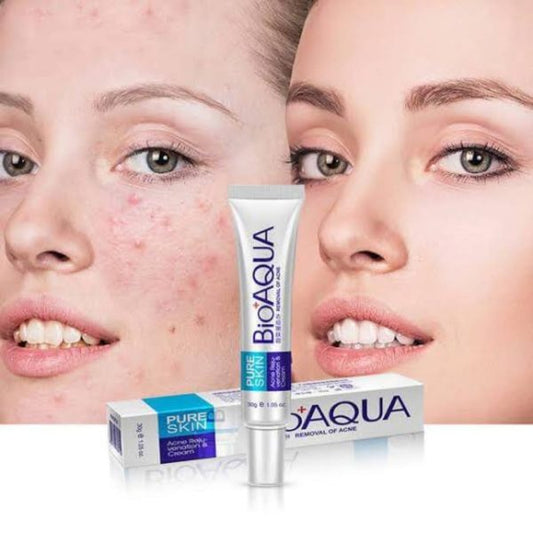 Bioaqua Anti Acne Cream Acne Scar Removal Cream